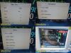 PHILIPS M8002A Intellivue MP30, W/ M3001A MMS Module & Leads ~ Monitor