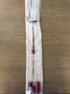 CARDIACASSIST 5130-1715 TandemHeart, Femoral Arterial Cannula Set, 15Fr, (X)