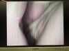 OLYMPUS WA50012A Laparoscope