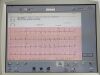 PHILIPS PAGEWRITER TOUCH SCREEN 860284 EKG ECG unit
