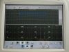 PHILIPS PAGEWRITER TOUCH SCREEN 860284 EKG ECG unit