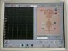 PHILIPS PAGEWRITER TOUCH SCREEN 860284 EKG ECG unit