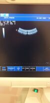 ESAOTE MyLab 15 Ultrasound - OB / GYN