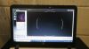 EASYSCAN Smart Retinal Imaging Confocal SLO Ophthalmoscope