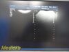PHILIPS C8-5 P/N 453561190821 Micro Convex Array Ultrasound Transducer