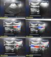 PHILIPS C8-5 P/N 453561190821 Micro Convex Array Ultrasound Transducer