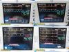 GE 2008  Dash 3000 (P/N 2035598-103) Patient Monitor