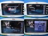 MASIMO 2012  Radical 7 Rainbow , W/ RDS-1 & One Piece Sensor ~ Oximeter - Pulse
