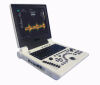 PLUSMED P20 B/W P20 Black and white ultrasound scanner