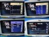 MASIMO 2012  Radical 7 Rainbow ,W/ RDS-3 Dock & SpO2 Sensor ~ Oximeter - Pulse