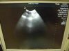 ZONARE C4-1 ULTRASOUND TRANSDUCER PROBE Ultrasound Transducer Ultrasound - OB / GYN - Vascular