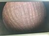 OLYMPUS A22001A Cystoscope