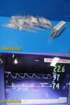 HEWLETT PACKARD M3000A MMS Module W/ ECG,SpO2,NBP,TEMP,IBP LEADS Bundle *TESTED*