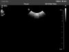 PHILIPS V6-2 Ultrasound Transducer