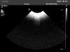 PHILIPS V6-2 Ultrasound Transducer