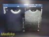 PHILIPS C8-4V Convex Array Endocavity Ultrasound Transducer