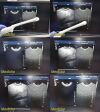 PHILIPS C8-4V Convex Array Endocavity Ultrasound Transducer