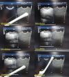 PHILIPS C8-4V (45361287503) Convex Array Endocavity Ultrasound Transducer