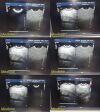 PHILIPS C8-4V Endocavity Probe Convex Array Ultrasound Transducer