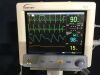 DATASCOPE Trio Vital Signs Monitor