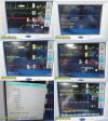 SPACELABS Ultraview 91369, W/ 91496 Module & New Leads ~  Patient Monitor