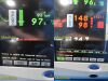 SPACELABS Ultraview 91369, W/ 91496 Module & Non-OEM Leads ~ Patient Monitor