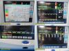 SPACELABS Ultraview 91369, W/ 91496 Module & Non-OEM Leads ~ Patient Monitor