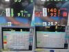 SPACELABS Ultraview 91369,W/ 91496 Module & NEW LEADS ~ Patient Monitor