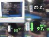 SPACELABS 91369 Ultraview SL, W/ 91496 Module NEW LEADS~Vital Signs Monitor