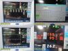 SPACELABS 91369 Ultraview SL, W/ 91496 Module NEW LEADS~Vital Signs Monitor