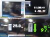 SPACELABS Ultraview SL 91369 ,W/ Module & Patient Leads~Vital Signs Monitor