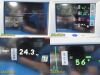 SPACELABS 91369 Ultraview SL ,W/ 91496 Module & Leads ~Patient Monitor