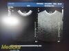 PHILIPS C8-4V (453561287502) Convex Array Endocavity Ultrasound Transducer