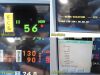 SPACELABS Ultraview SL 91369W/ 91496 & Patient Leads ~ Patient Monitor