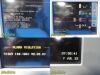 SPACELABS 91369 Ultraview SL , W/ Module,SpO2,ECG,NBP,TEMP Leads ~ Monitor