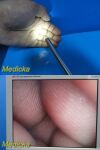 STRYKER 502-457-010 Rigid 10mmx0° Telescope, Laparoscope, Autoclavable