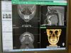 VATECH Green 21 Dental X-Ray