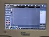 BARD Site-Rite Vision Ultrasound System 9770032 w/ Probe 9770033 Ultrasound - Cardiac - Vascular
