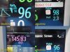 PHILIPS M8002A Intellivue MP30,W/ M3001A MMS Module, Patient Leads~ Monitor