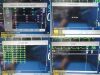 PHILIPS M8002A Intellivue MP30,W/ M3001A MMS Module, Patient Leads~ Monitor