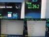 PHILIPS M8002A Intellivue MP30,W/ M3001A MMS Module, Patient Leads~ Monitor