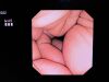 OLYMPUS GIF-XP180N Gastroscope
