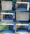 PHILIPS Intellivue MP30 (M8002A),W/ M3001A Module & Patient Leads ~ Monitor