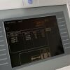GE Dash 2000 Monitor