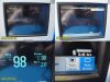 PHILIPS 2008 MP5T 865120 (M8105AT)  W/ SpO2 & NBP Patient Leads ~ Monitor