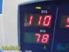 WELCH ALLYN Hill Rom W.A 300 Series Vital Signs Monitor