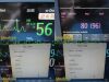 PHILIPS Intellivue MP30 Multiparameter Monitor