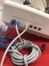 PHILIPS AVALON FM30 Fetal Monitor