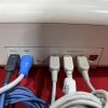 PHILIPS AVALON FM30 Fetal Monitor