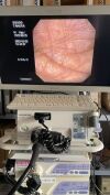OLYMPUS PCF-Q150AI Colonoscope